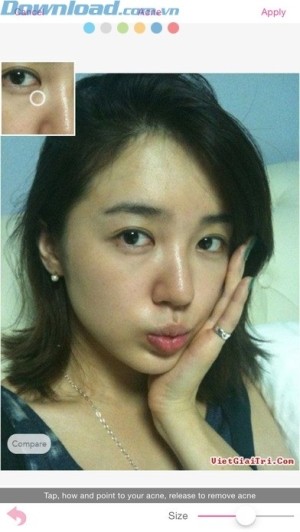 Xóa mụn trên mặt