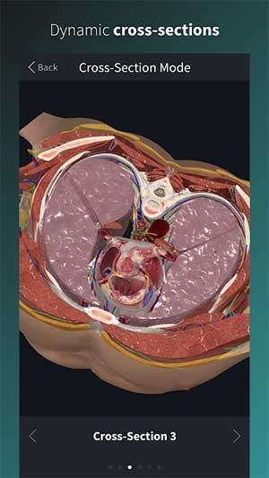 Các lớp cắt nội tạng chân thực