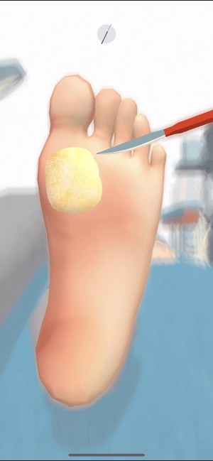 Điều trị các vấn đề về chân cho bệnh nhân