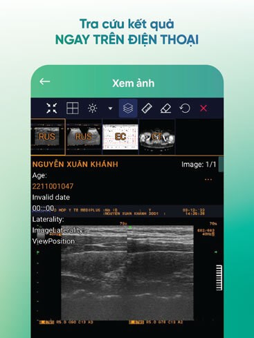 Tra cứu kết quả khám bệnh