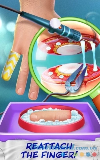 Phẫu thuật nối khớp ngón tay